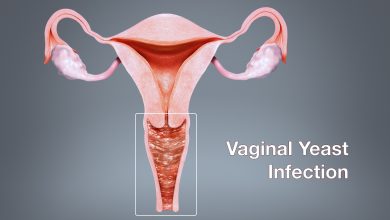 Buy Everything You Want to Know About Vaginal Yeast Infections